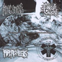 4​-ensic Undergrind Methodology